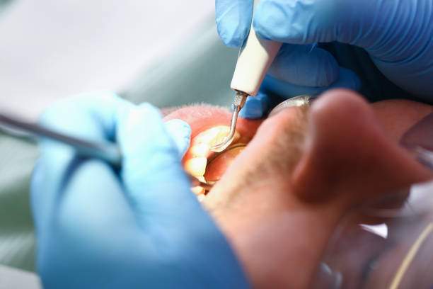 Best Emergency Root Canal Treatment in Woodsboro, MD