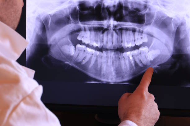 Best Emergency Dental Care for Abscessed Tooth in Woodsboro, MD