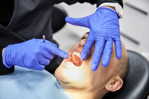 Best Broken or Cracked Tooth Emergency Dentist in Woodsboro, MD